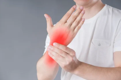 two conditions that are often misdiagnosed as carpal tunnel syndrome