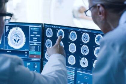 doctorhub360.com neurological diseases